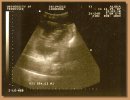 Junebug's ultrasound taken on November 19th, 2007.